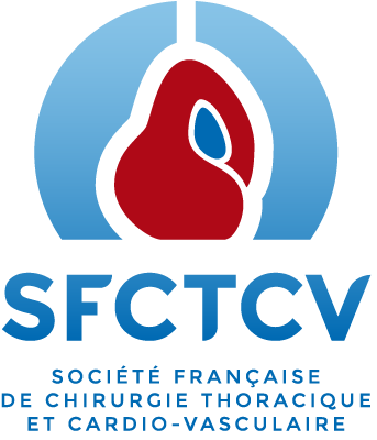 SFCTCV